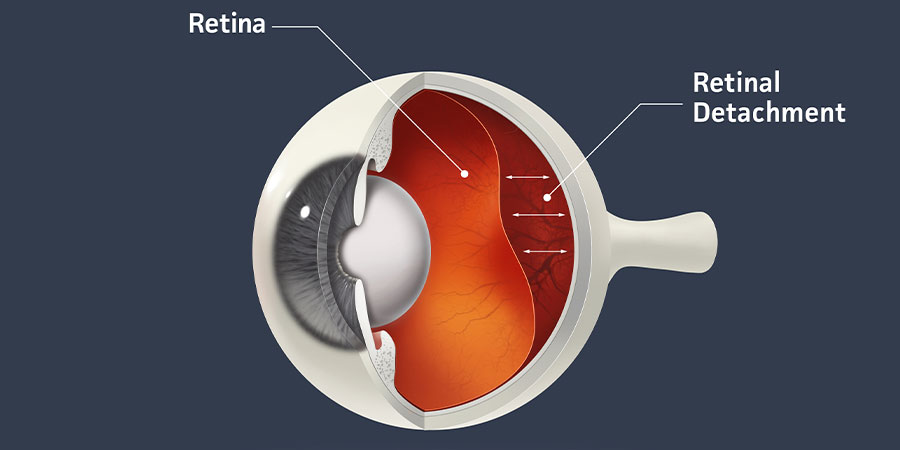 Retinal examination and surgery