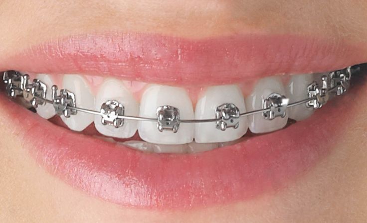 Orthodontics